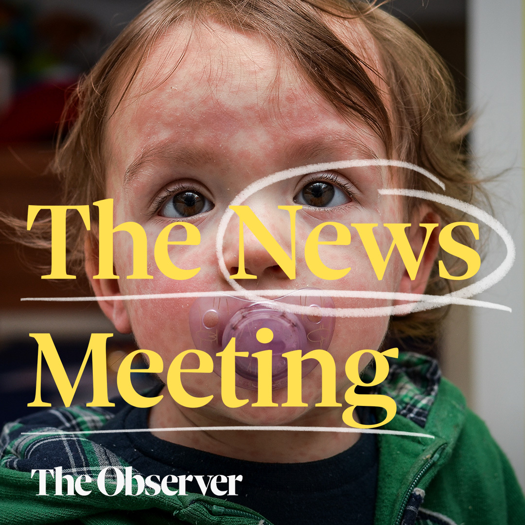 What’s fueling a rise in measles cases in the UK?